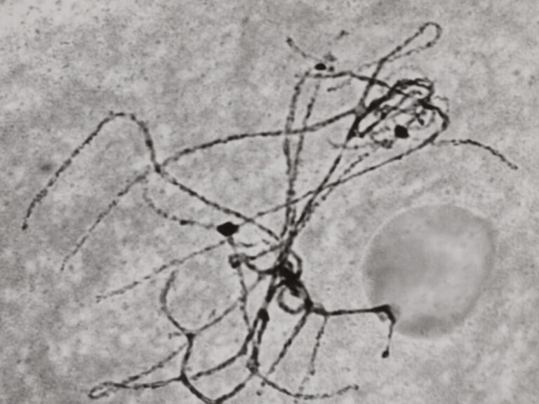 black and white image with a black tangled line a gray egg-shaped blob