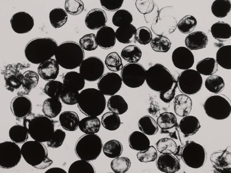 irregular and misshapen pollen grains, many of them semi-transparent and shriveled